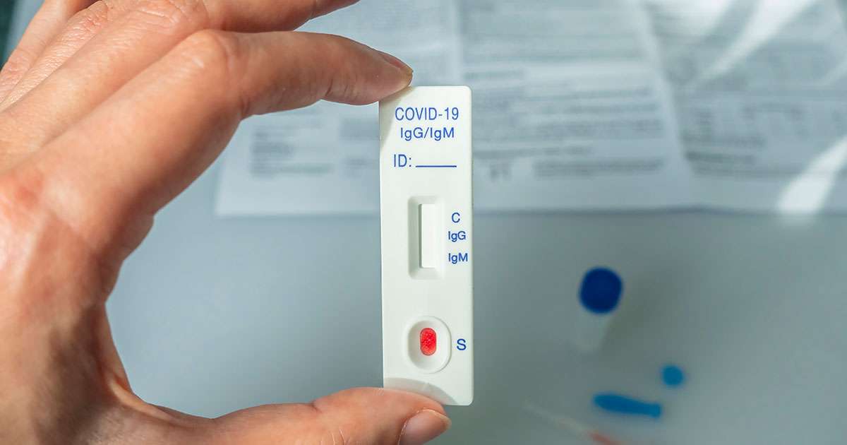 Las farmacias gallegas podrán vender test de autodiagnóstico de Covid-19  sin receta - Metropolitano